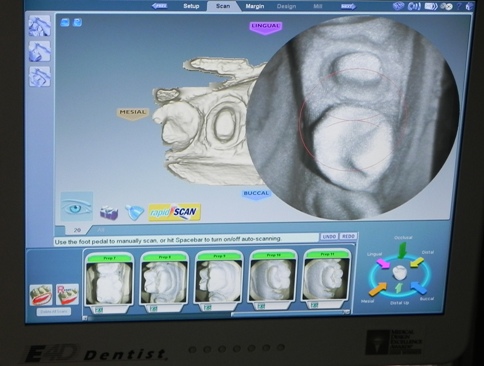 E4D Dentistry equipment